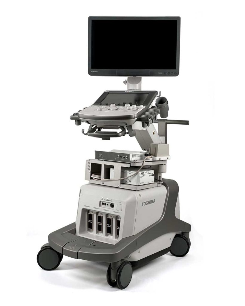 Toshiba_Aplio_Ultrasound